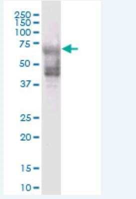 Western Blot: KRT74 Antibody [H00121391-B01P-50ug]