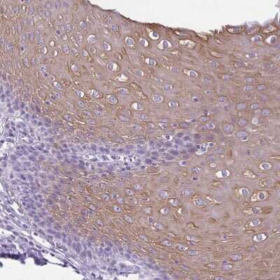 Immunohistochemistry-Paraffin: KRT78 Antibody [NBP1-93671]