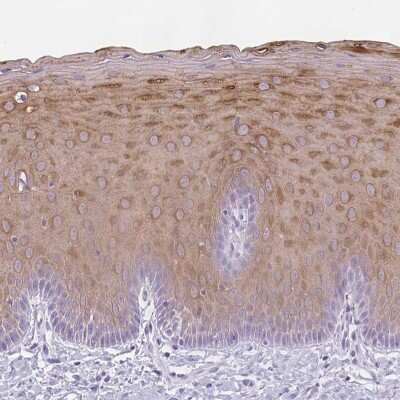 Immunohistochemistry-Paraffin: KRT78 Antibody [NBP1-93671]