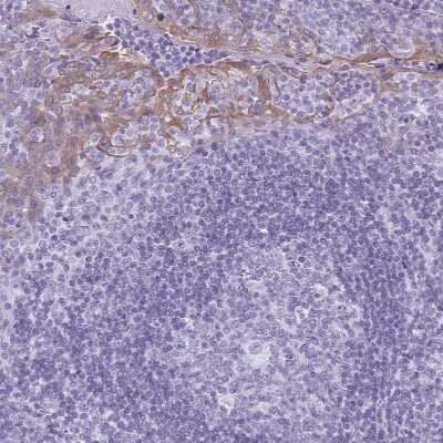 Immunohistochemistry-Paraffin: KRT78 Antibody [NBP1-93671]