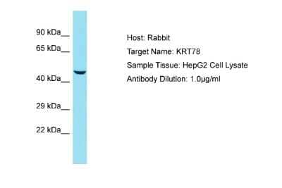 Western Blot: KRT78 Antibody [NBP2-83129]