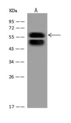 Western Blot: KRT78 Antibody [NBP3-06028]