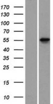 Western Blot: KRT78 Overexpression Lysate [NBP2-05140]