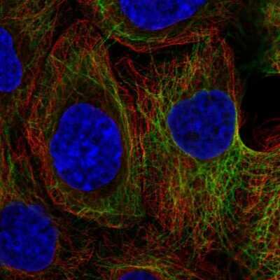 Immunocytochemistry/ Immunofluorescence: KRT80 Antibody [NBP2-58015]