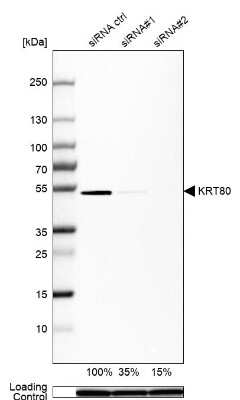 Western Blot: KRT80 Antibody [NBP2-58851]