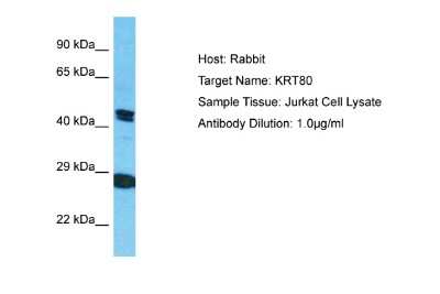 Western Blot: KRT80 Antibody [NBP2-85172]