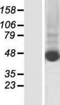 Western Blot: KRT80 Overexpression Lysate [NBP2-08421]