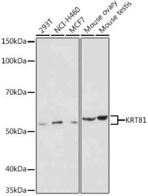 Western Blot: KRT81 AntibodyAzide and BSA Free [NBP3-04880]