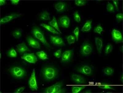 Immunocytochemistry/ Immunofluorescence: KRT81 Antibody (3B10-5B10) [H00003887-M01]