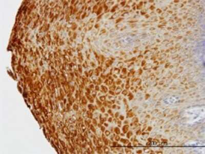 Immunohistochemistry-Paraffin: KRT81 Antibody (3B10-5B10) [H00003887-M01]