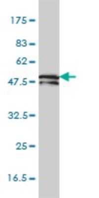 Western Blot: KRT81 Antibody (3B10-5B10) [H00003887-M01]