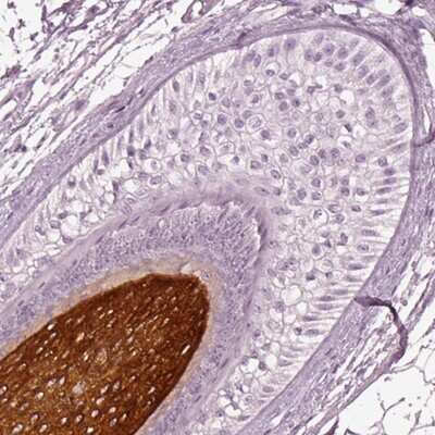 Immunohistochemistry-Paraffin: KRT81 Antibody [NBP2-57133]