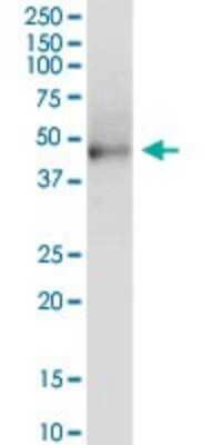 Western Blot: KRT81 Antibody [H00003887-D01P]