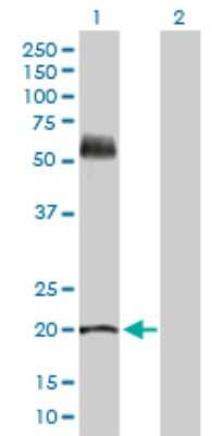 Western Blot: KRT81 Antibody [H00003887-D01P]