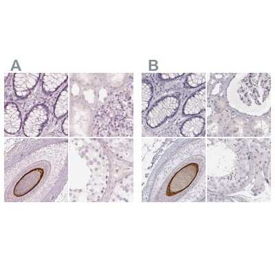 Immunohistochemistry-Paraffin: KRT82 Antibody [NBP2-31727]