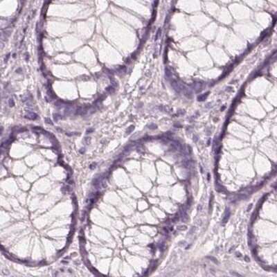 Immunohistochemistry-Paraffin: KRT82 Antibody [NBP2-31727]