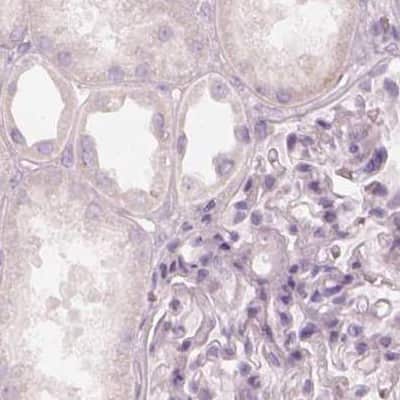 Immunohistochemistry-Paraffin: KRT82 Antibody [NBP2-31727]