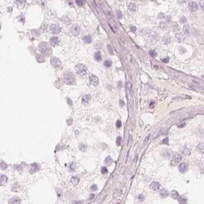 Immunohistochemistry-Paraffin: KRT82 Antibody [NBP2-31727]