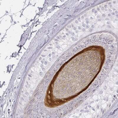 Immunohistochemistry-Paraffin: KRT82 Antibody [NBP2-57921]