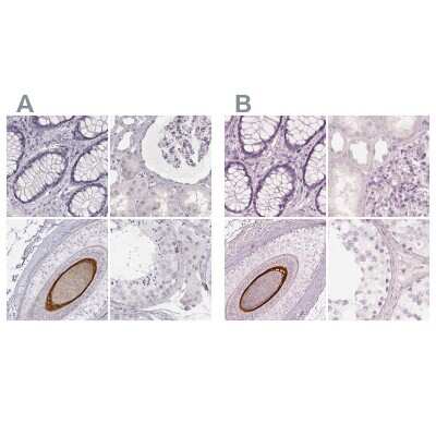 Immunohistochemistry-Paraffin: KRT82 Antibody [NBP2-57921]