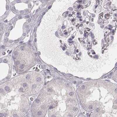 Immunohistochemistry-Paraffin: KRT82 Antibody [NBP2-57921]