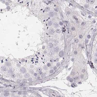 Immunohistochemistry-Paraffin: KRT82 Antibody [NBP2-57921]