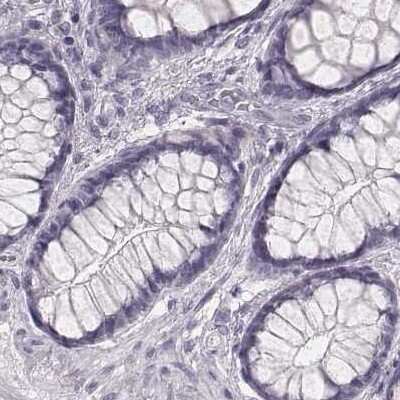 Immunohistochemistry-Paraffin: KRT82 Antibody [NBP2-57921]