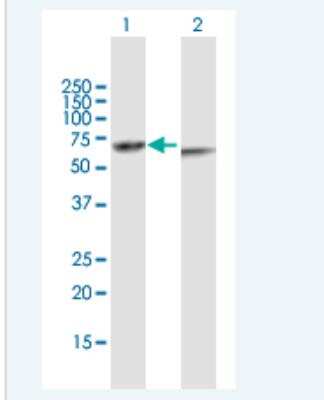 Western Blot: KRT82 Antibody [H00003888-B01P-50ug]