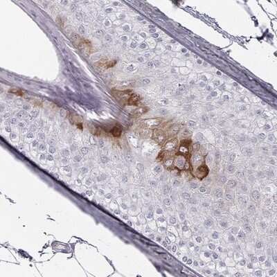 Immunohistochemistry-Paraffin: KRT84 Antibody [NBP2-58176]