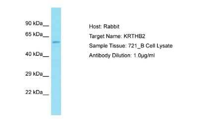 Western Blot: KRT84 Antibody [NBP2-85174]