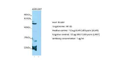 Western Blot: KRT85 Antibody [NBP2-84123]