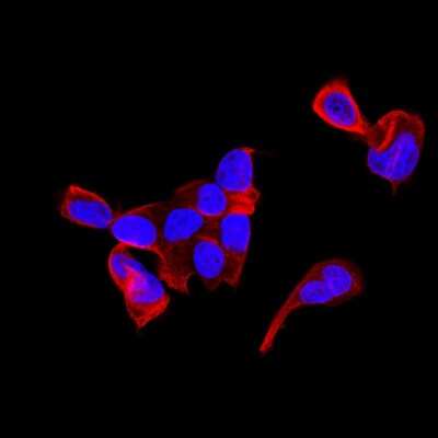 Immunocytochemistry/ Immunofluorescence: KRT9 Antibody (SD201-09) [NBP2-67810]