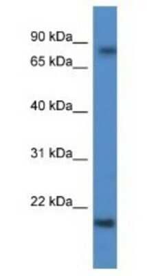 Western Blot: KRTAP1-5 Antibody [NBP1-79847]