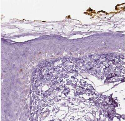 Immunohistochemistry-Paraffin: KRTAP11-1 Antibody [NBP2-55564]