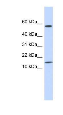 Western Blot: KRTAP11-1 Antibody [NBP1-91597]