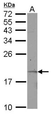 Western Blot: KRTAP11-1 Antibody [NBP2-19309]