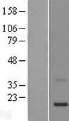 Western Blot: KRTAP11-1 Overexpression Lysate [NBP2-05054]