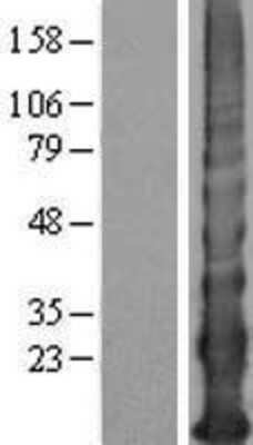 Western Blot: KRTAP12-4 Overexpression Lysate [NBP2-04678]