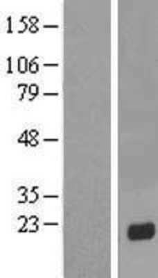 Western Blot: KRTAP13-2 Overexpression Lysate [NBL1-12403]