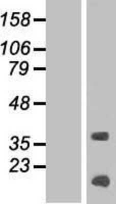 Western Blot: KRTAP13-4 Overexpression Lysate [NBP2-04915]