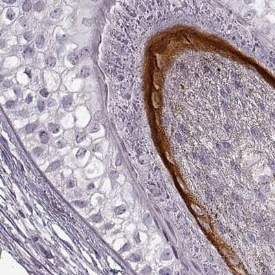 Immunohistochemistry-Paraffin: KRTAP16-1 Antibody [NBP2-57981]