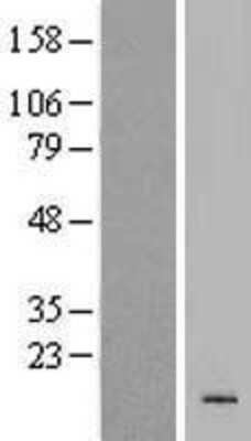 Western Blot: KRTAP19-4 Overexpression Lysate [NBP2-04916]