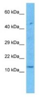 Western Blot: KRTAP2-1 Antibody [NBP3-09400]