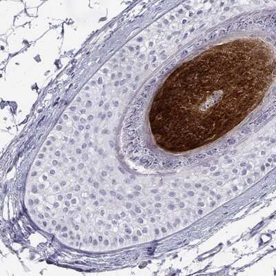 Immunohistochemistry-Paraffin: KRTAP2-4 Antibody [NBP2-57069]