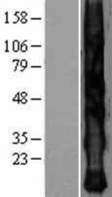 Western Blot: KRTAP2-4 Overexpression Lysate [NBL1-12405]