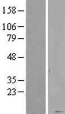 Western Blot: KRTAP20-1 Overexpression Lysate [NBL1-12406]