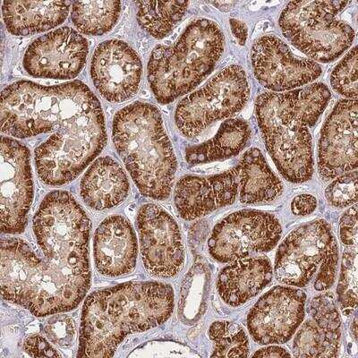 Immunohistochemistry-Paraffin: KRTAP21-3 Antibody [NBP2-14570]