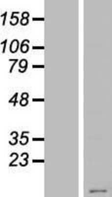 Western Blot: KRTAP23-1 Overexpression Lysate [NBP2-04917]