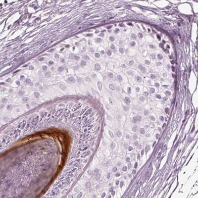 Immunohistochemistry-Paraffin: KRTAP24-1 Antibody [NBP2-55326]