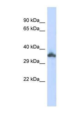 Western Blot: KRTAP24-1 Antibody [NBP1-91600]